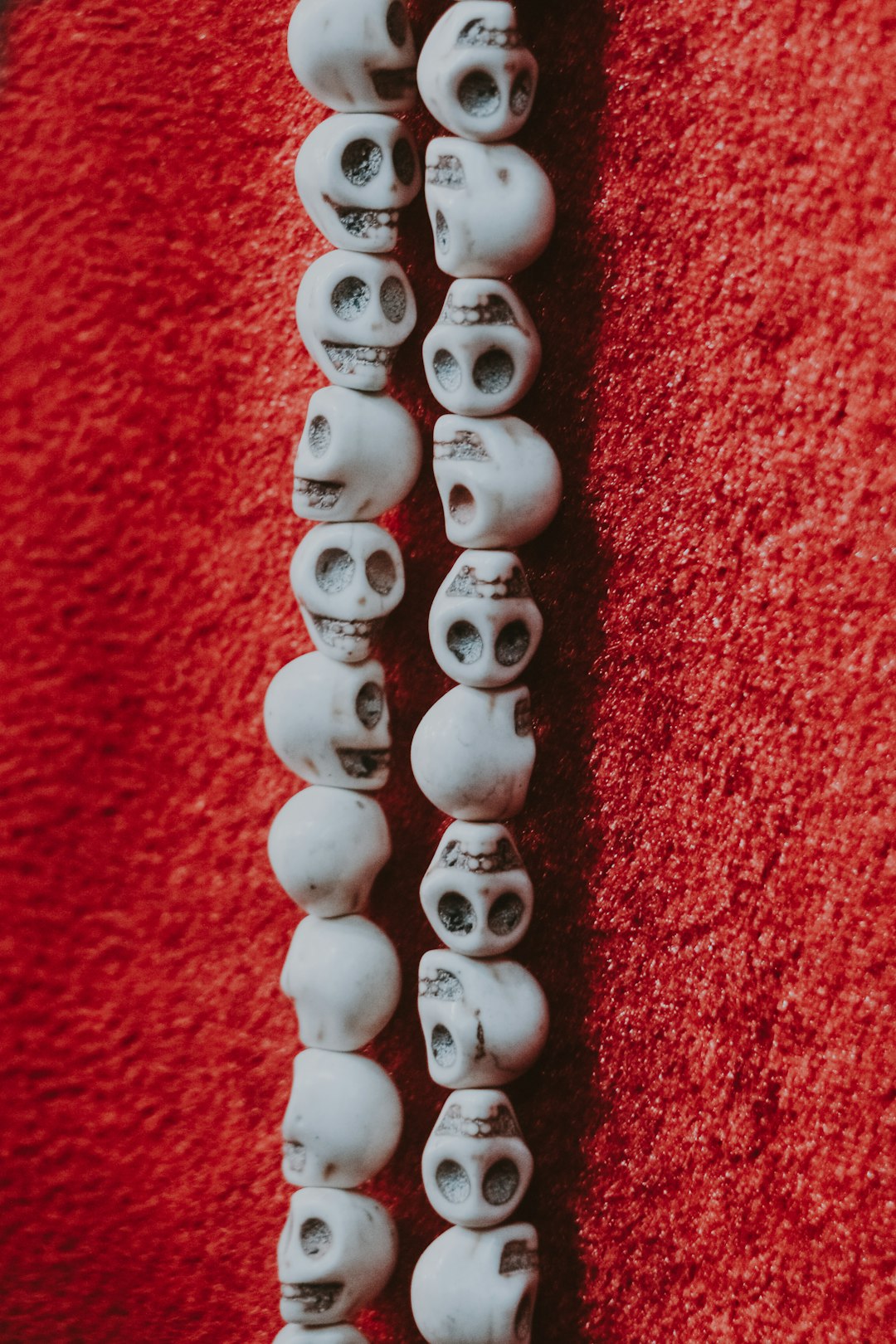 Traditional Metal Braces