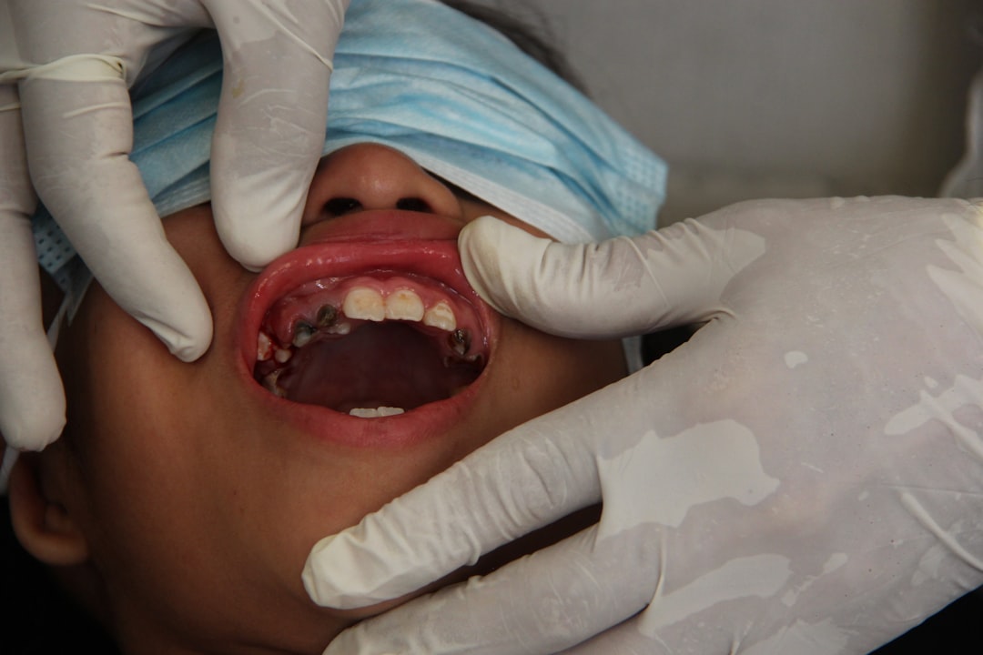 Dental Sedation