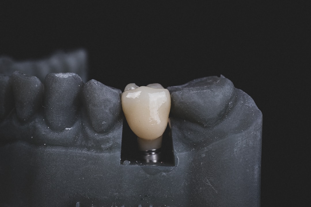 Dental Crown