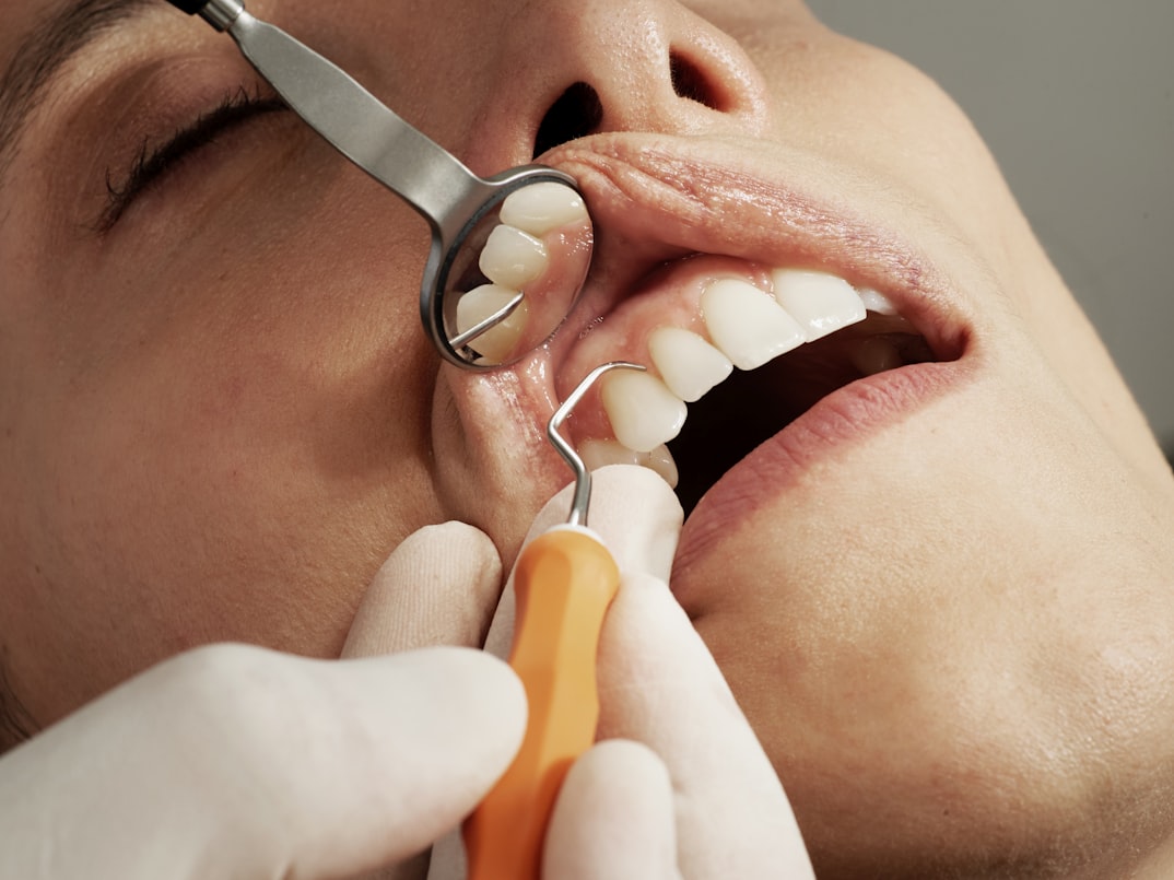 Prosthetic dental treatment